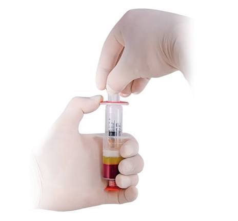 Gloved handling of a plasma preparation syringe