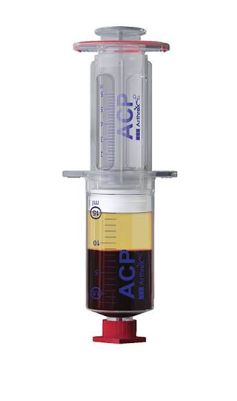 Arthrex ACP Max system with separated blood components