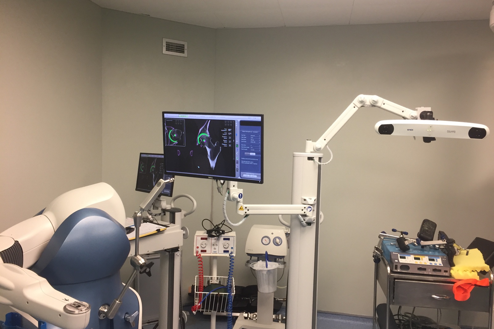 Robotic-assisted hip replacement system