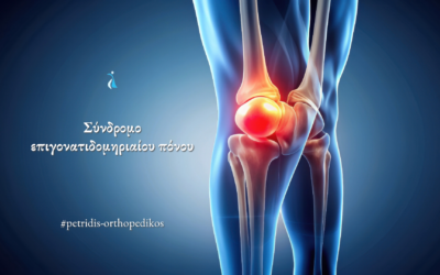 Σύνδρομο επιγονατιδομηριαίου πόνου