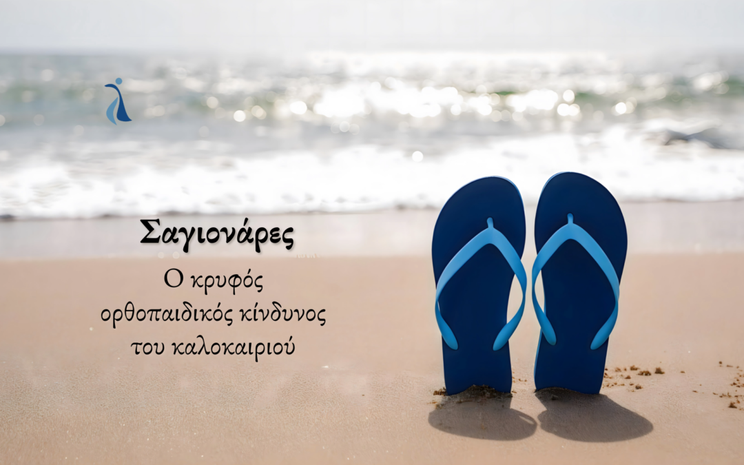 Σαγιονάρες: Ο κρυφός ορθοπαιδικός κίνδυνος του καλοκαιριού