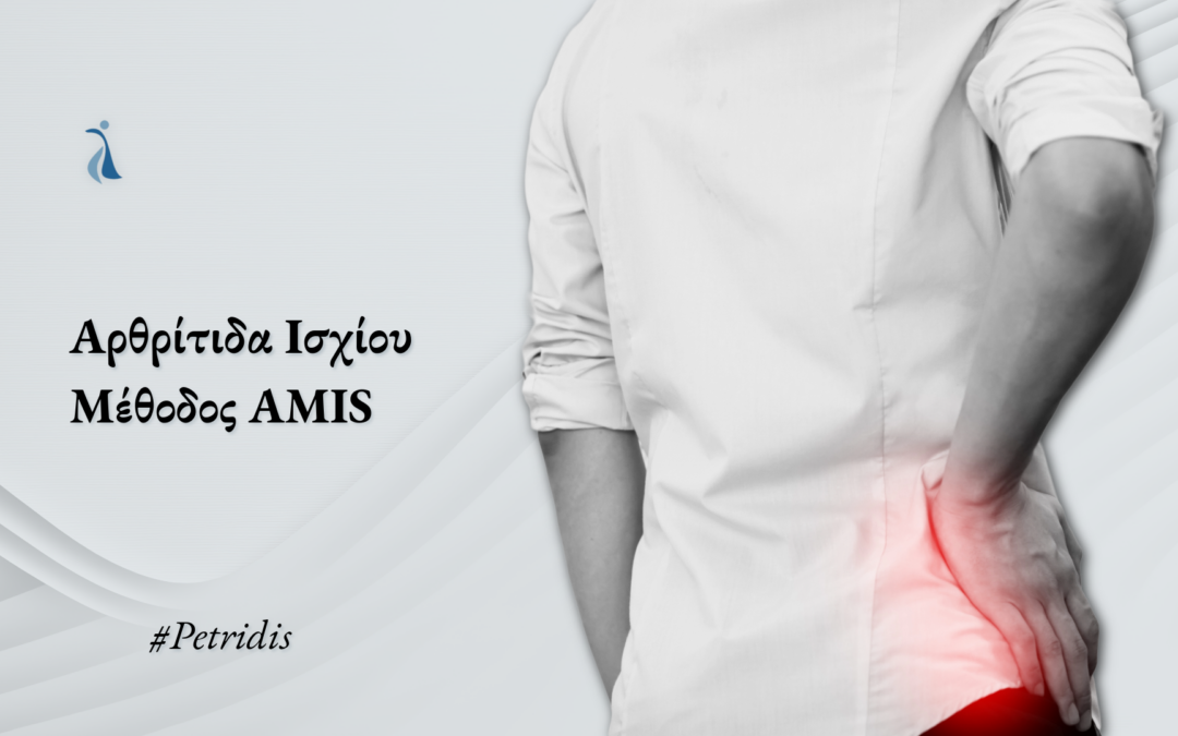 Αρθρίτιδα Ισχίου – Μέθοδος AMIS